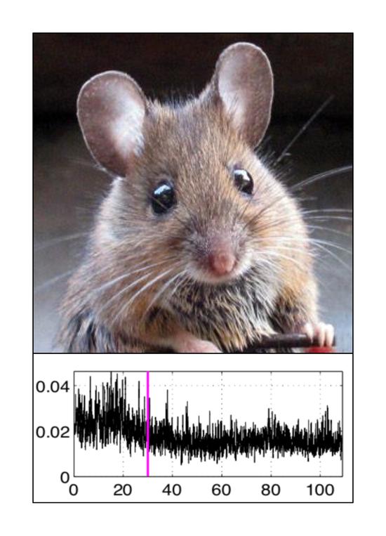 How does Anesthesia Change the Complexity of Physiological Signals?